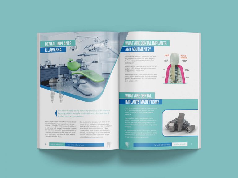 Dental Implants Booklet/Brochure