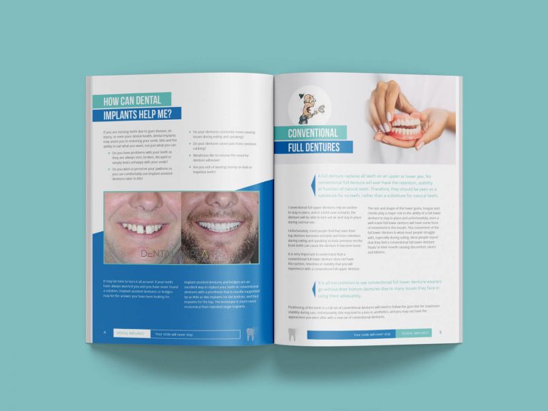 Dental Implants Booklet/Brochure