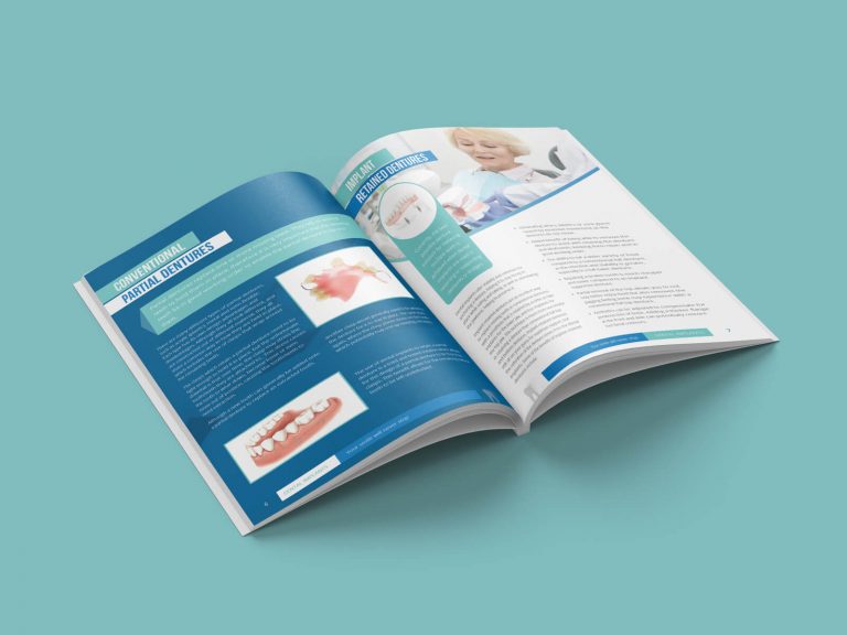 Dental Implants Booklet/Brochure