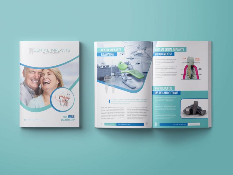 Dental Implants Booklet/Brochure